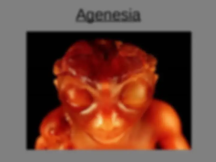 pfa