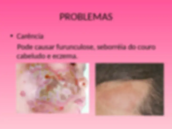 pf21