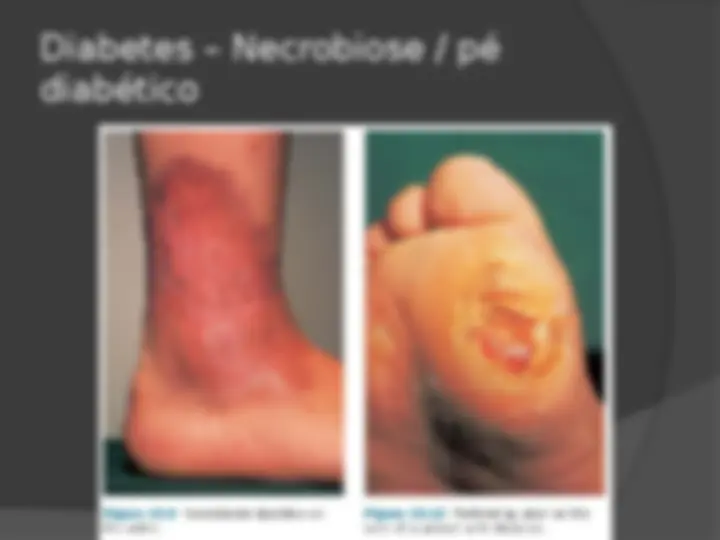 pf31