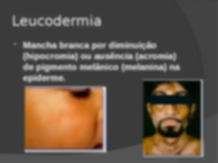 pfe
