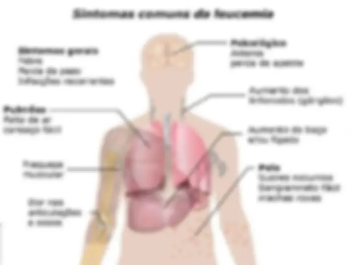 pfa