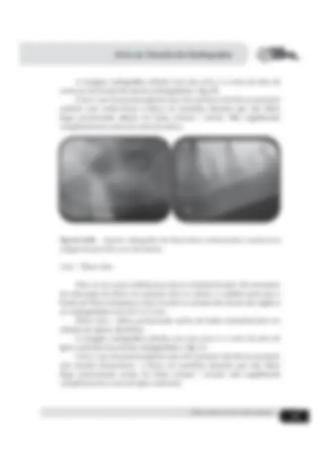 pf1a