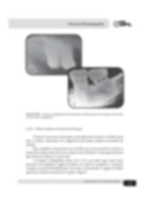 pf38
