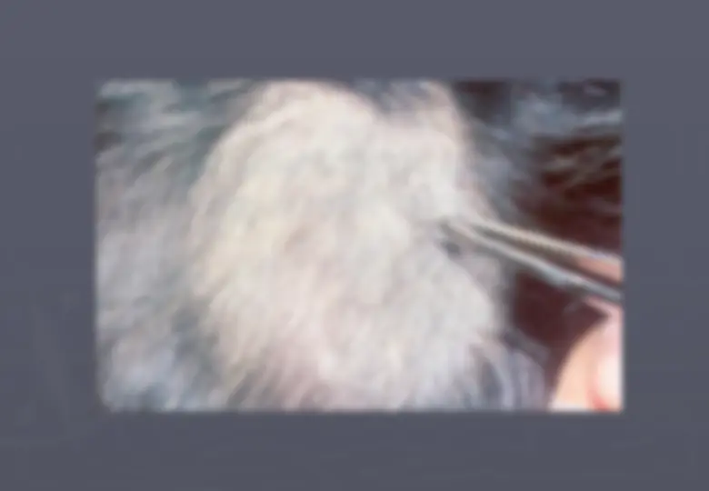 pfa