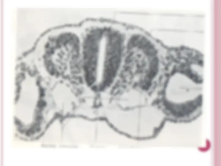 pf21