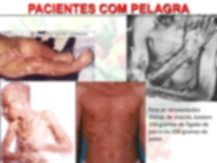 pf16