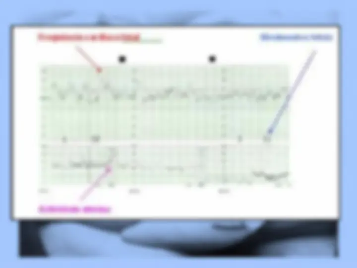 pf27