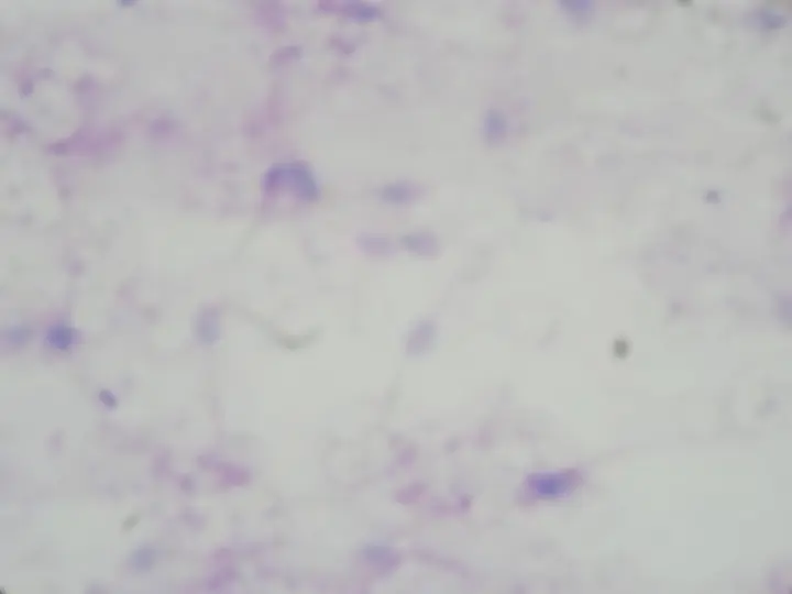 pf14