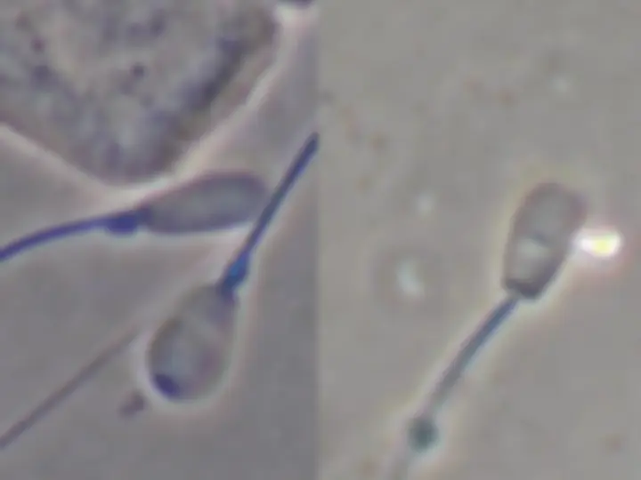 pf1b