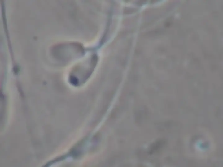 pf15