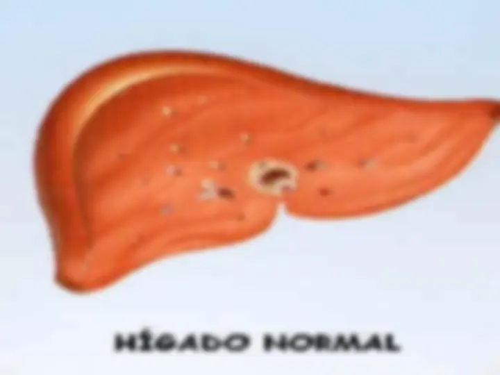pfa