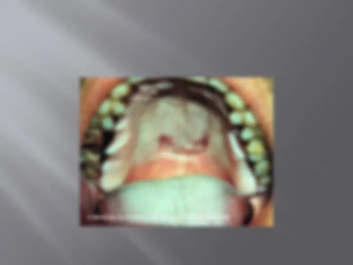 pfe