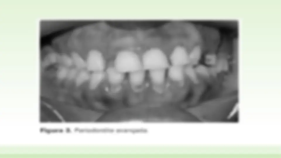 pf3