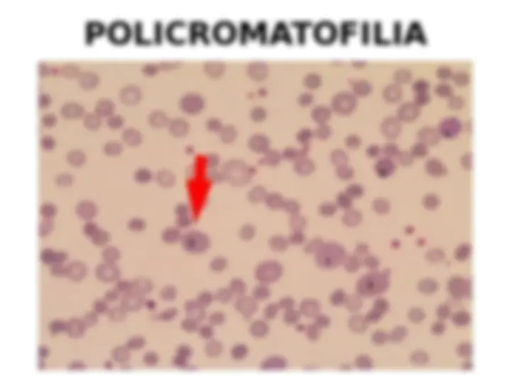 pf15