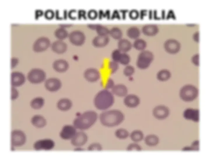pf14