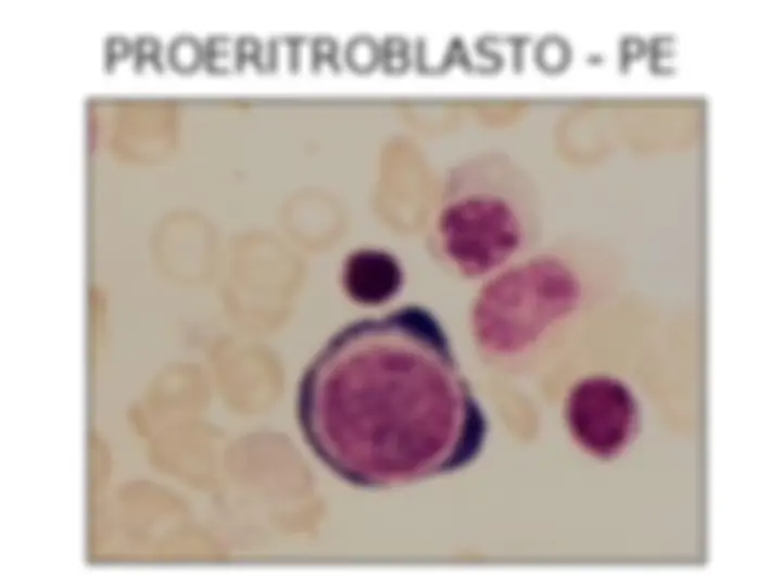 pf20