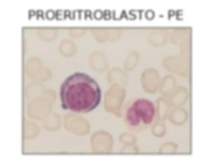 pf21