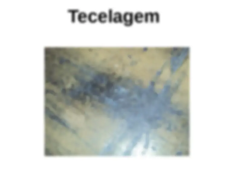 pfe