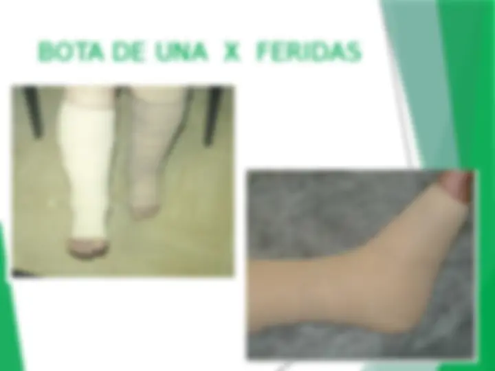 pf18
