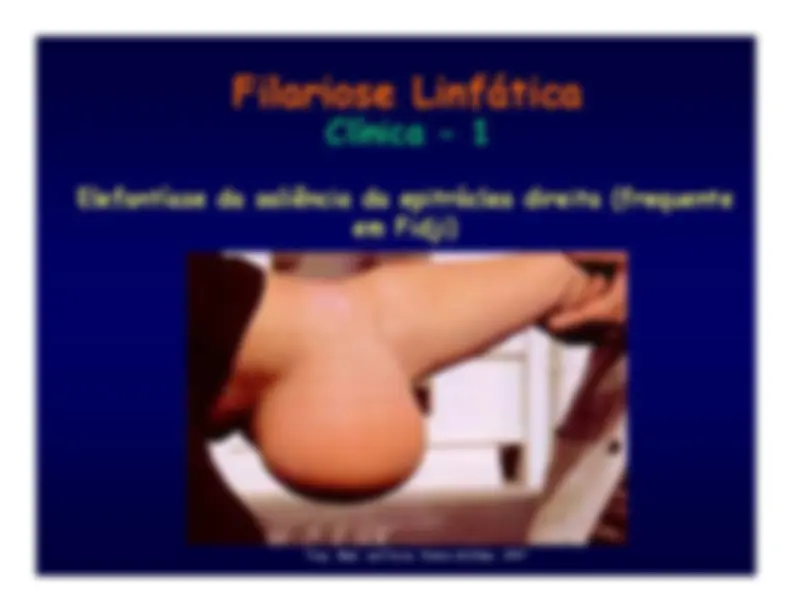 pf13