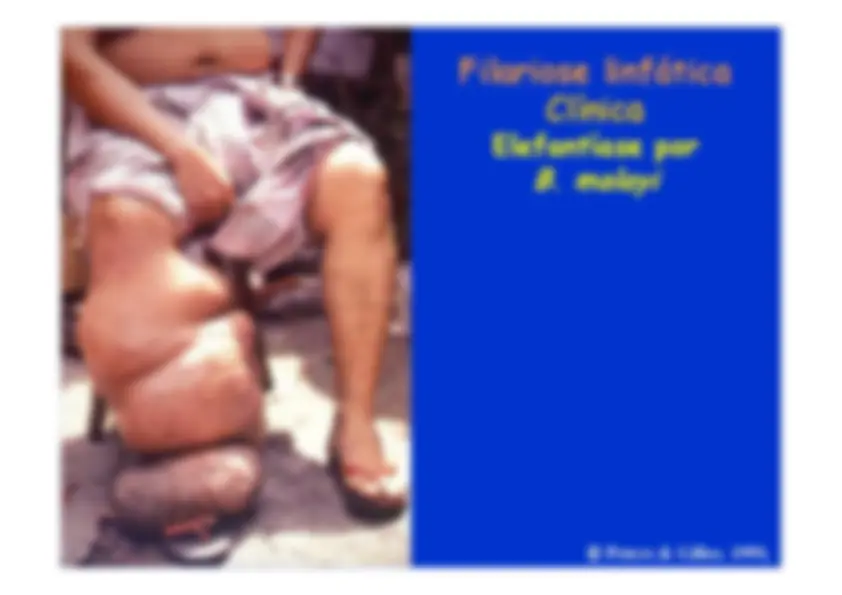 pf12