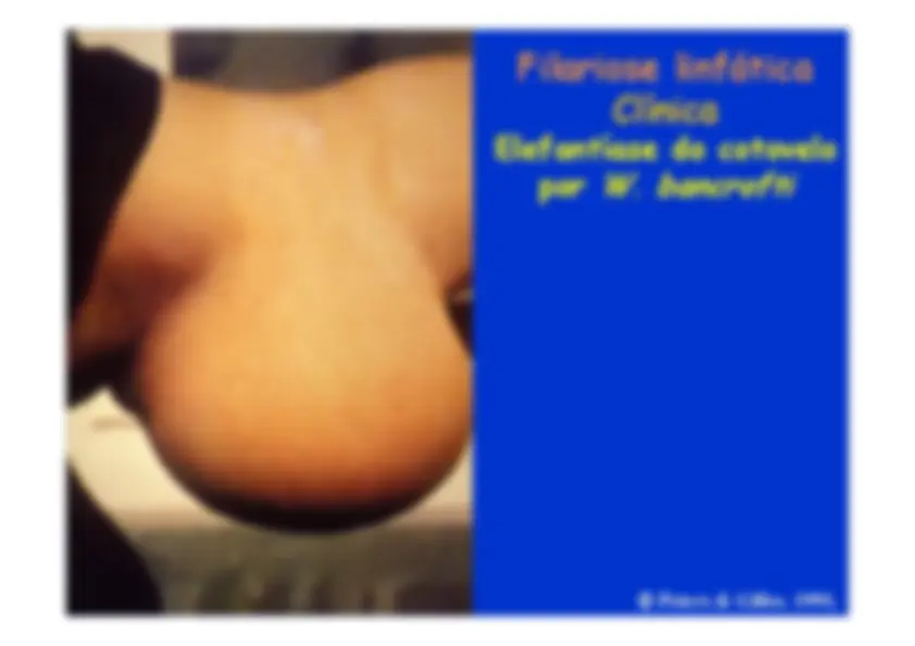 pf16