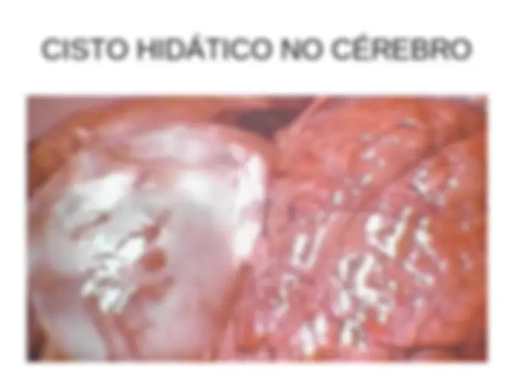 pff