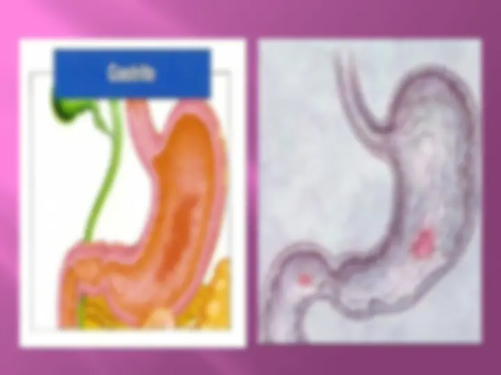 pf5