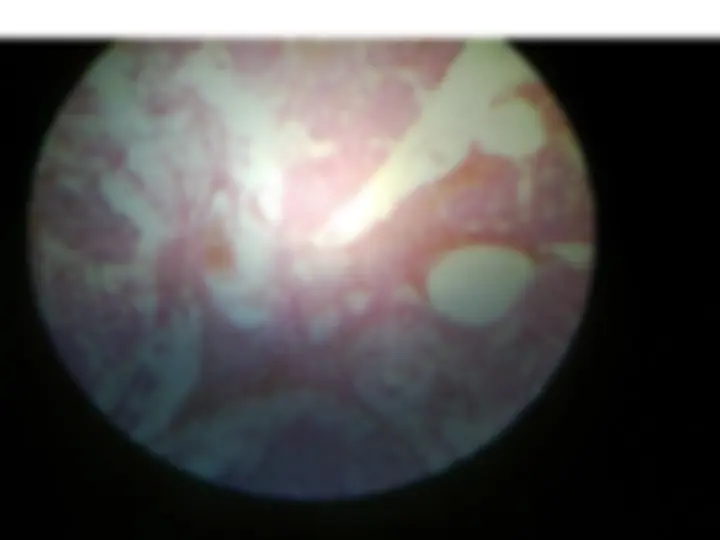 pf57
