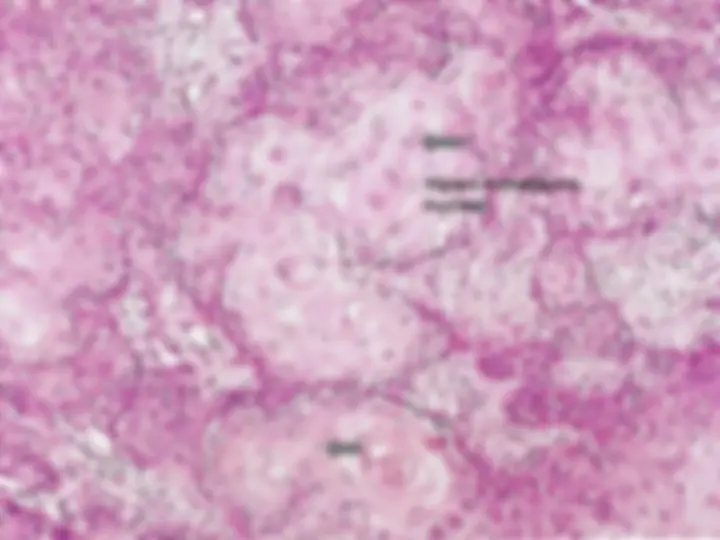 pf59