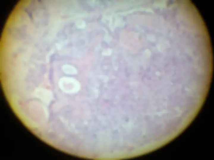 pf53