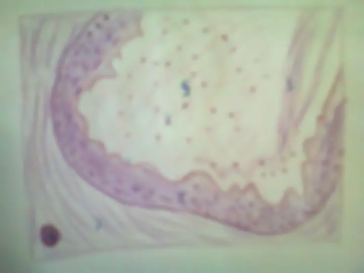 pf23