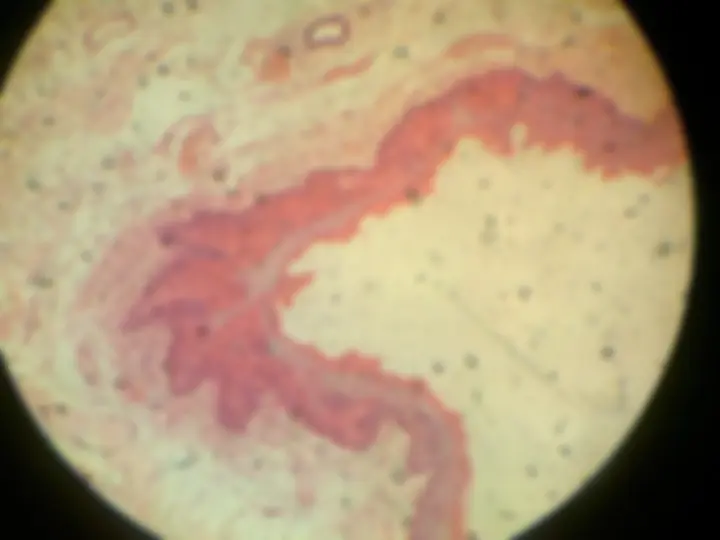 pf28