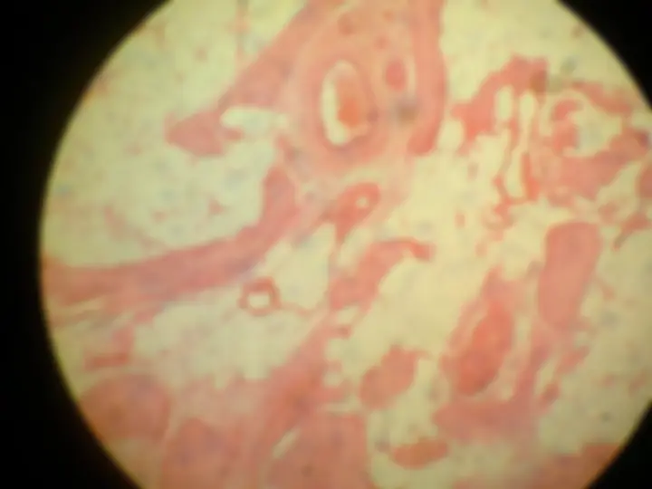 pf42