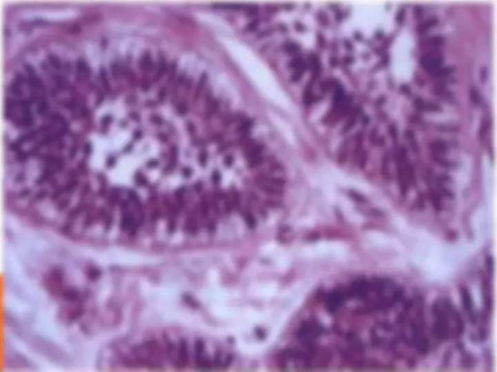 pf35