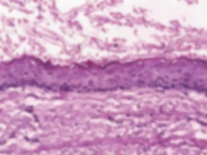 pf1f