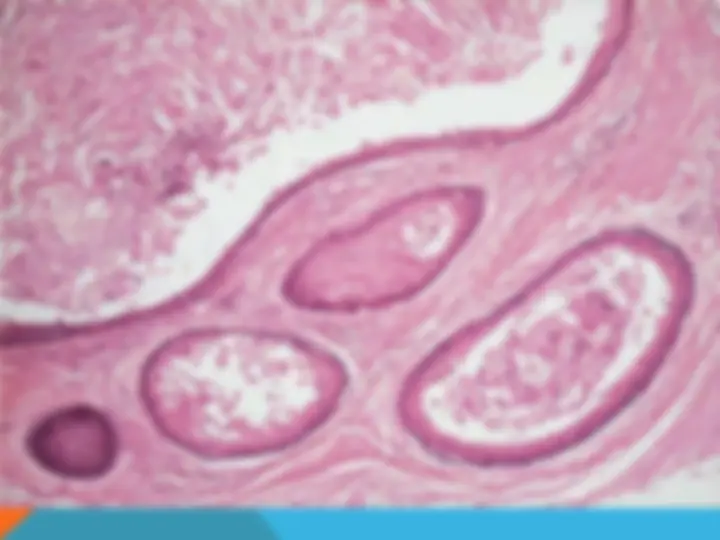 pf1a