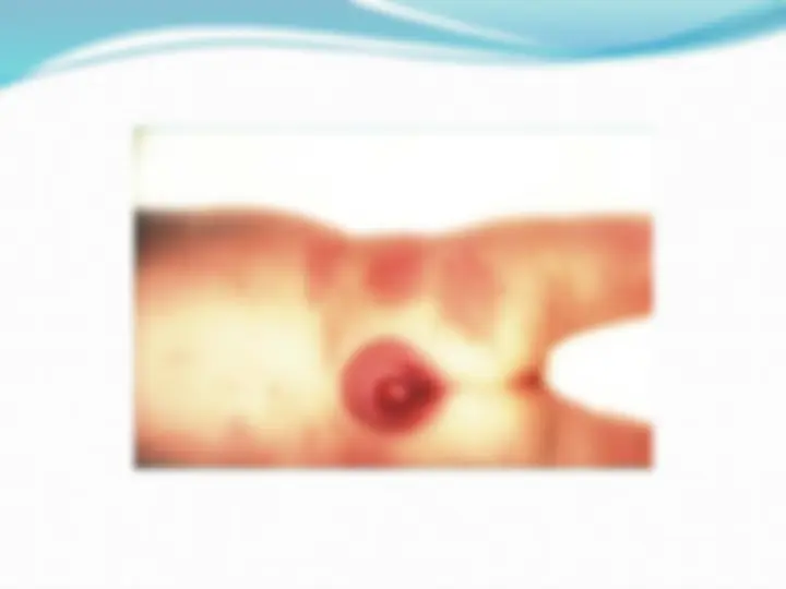 pf4
