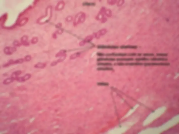 pf1a