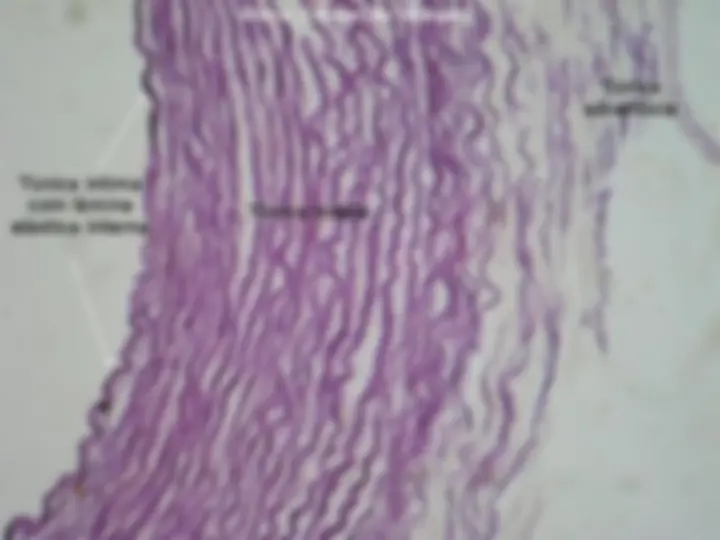 pf29