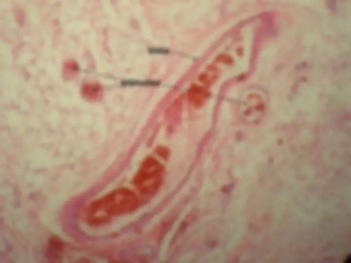 pf15