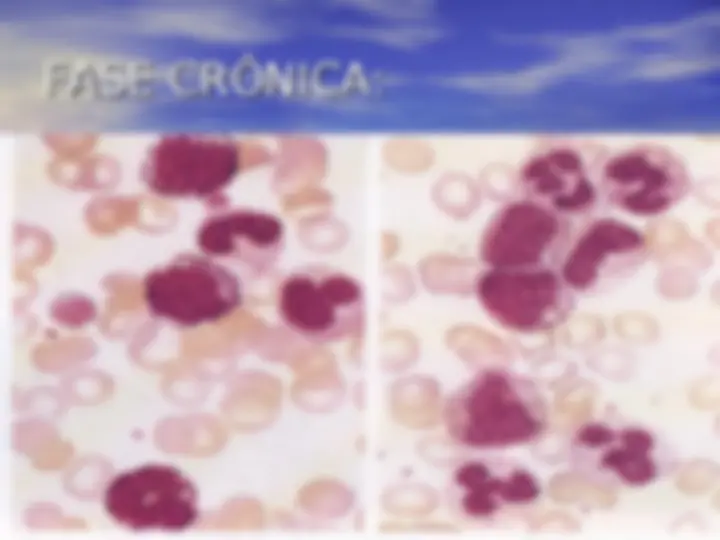 pf4c