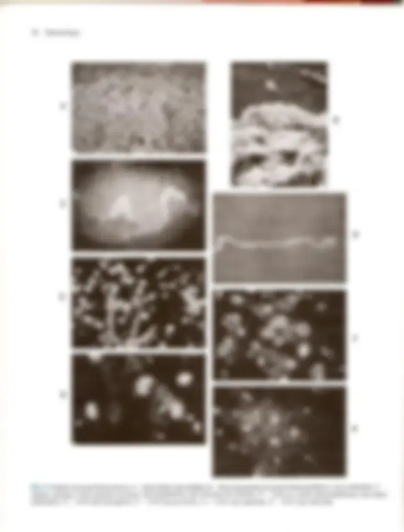 pf1b