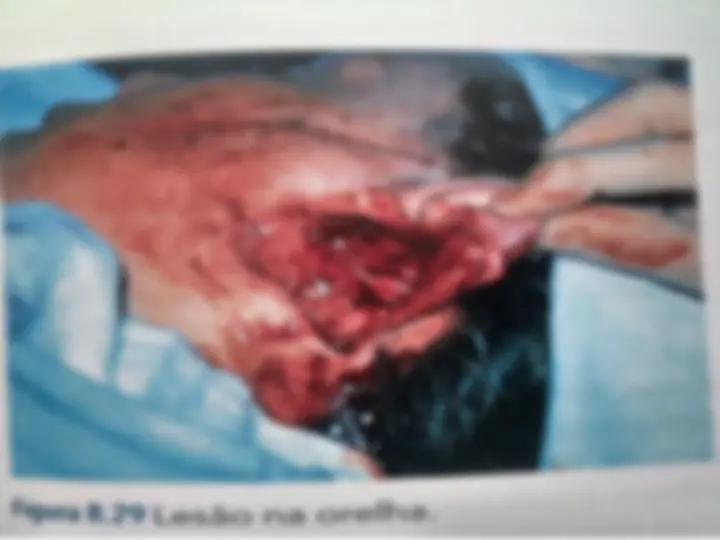 pf27