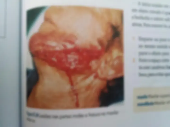 pf24