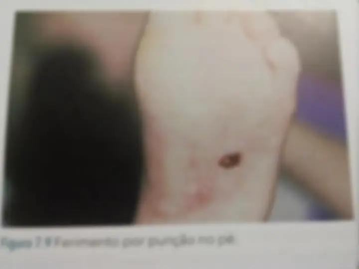 pfe