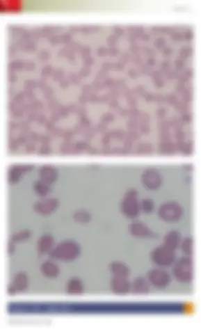 pf26