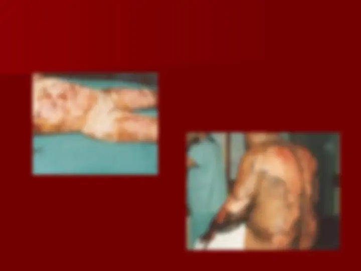 pfa