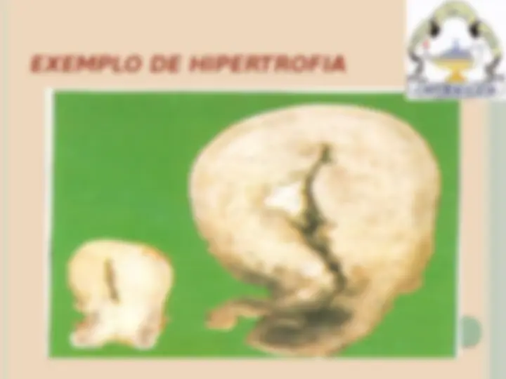 pf47