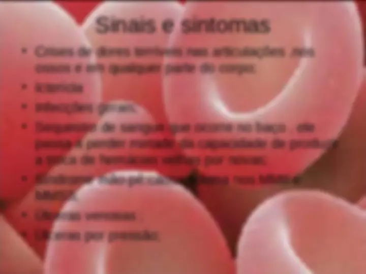 pf15